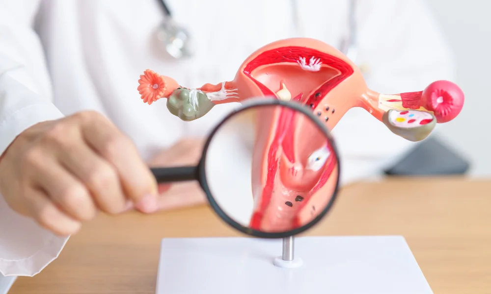 Ovarian Cyst Treatment & Care in Secunderabad – Dr. Prodduturu Padmaja 
